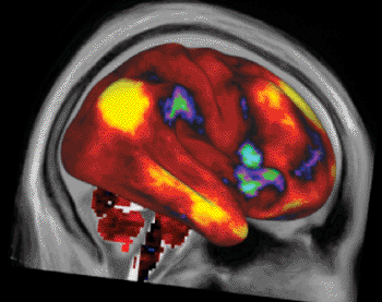 Image: A map of average “functional connectivity” in human cerebral cortex (including subcortical gray matter). Regions in yellow are functionally connected to a “seed” location in the parietal lobe of the right hemisphere, whereas regions in red and orange are weakly connected or not connected at all (Photo courtesy of Washington University in St. Louis).